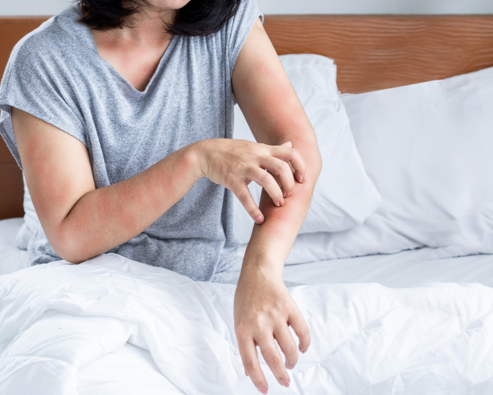 Femme subissant des allergies ou acariens à cause de son matelas peu nettoyé